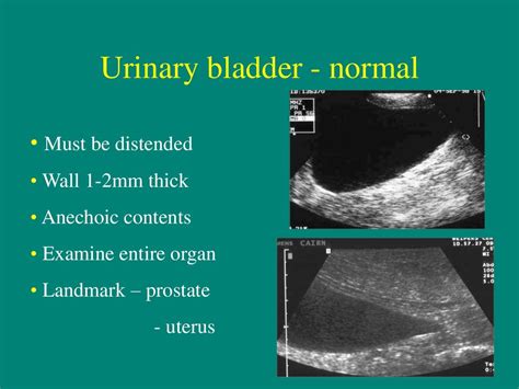 measuring bladder wall thickness ultrasound|bladder ultrasound indications.